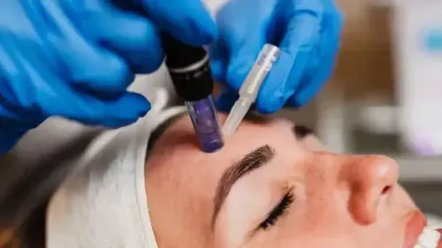 Scar Revision Surgery Cost in India: Full Guide
